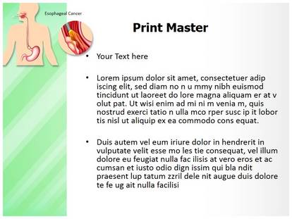 Free Esophageal Cancer Medical Medical PowerPoint Template For Medical ...